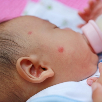 5 Pilihan Produk Penangkal Nyamuk Untuk Bayi dan Anak-Anak