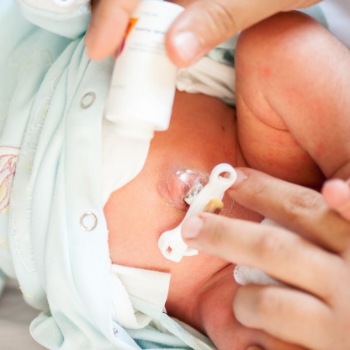 Merawat Tali Pusat Bayi, yang Boleh dan Tidak Boleh