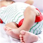 Stimulasi Untuk Bayi Bilateral Clubfoot